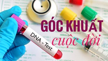 Kịch tình huống 